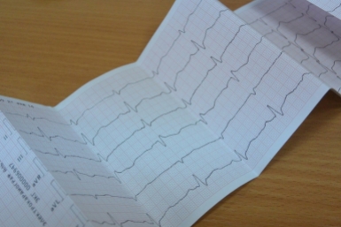 Врач рассказал, кто чаще всего переносит инфаркт на ногах Автор: Наталья Баграновская, ИА EAOmedia