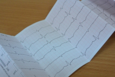 Врач рассказала, как избежать проблем с сердцем Наталья Баграновская, ИА EAOmedia